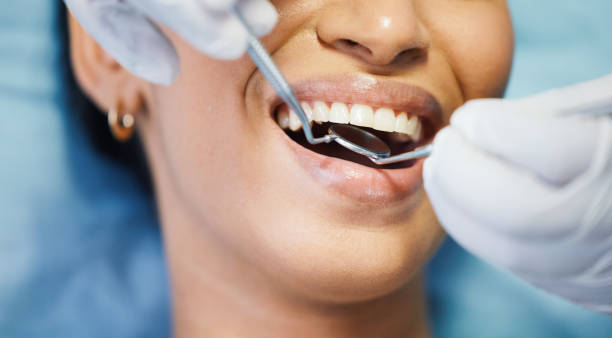 Best Emergency Root Canal Therapy in Iowa Park, TX