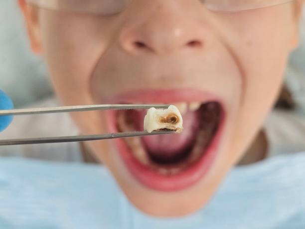 Best Emergency Pediatric Dental Care in Iowa Park, TX